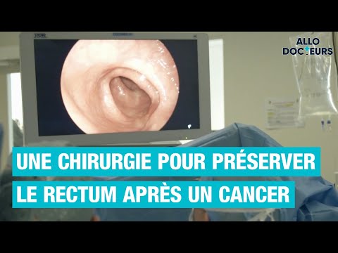 Vidéo: Le cancer du rectum peut-il causer des maux de dos ?