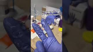 Pelvic Examination