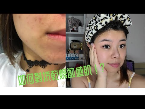 「真人實測」超有效！！！對抗乾燥敏感肌 轉季必看！！！