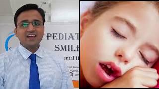 Dr Mihir Shah-Effect Of Mouth Breathing & Breastfeeding On Growth Of The Face & Jaws & Crooked Teeth
