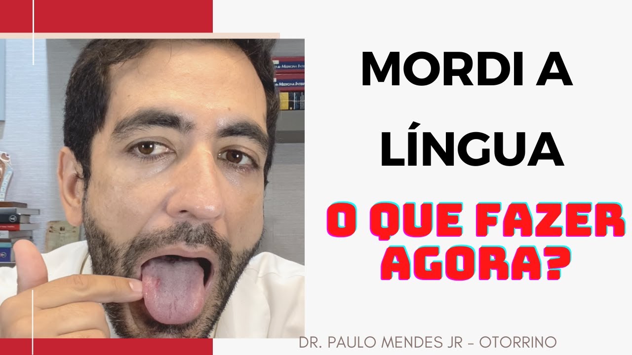 O QUE FAZER APÓS MORDER A LINGUA?