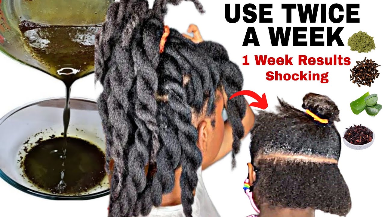 I'm still shocked! Overnight Hair Growth Treatment! Grow Hair FAST