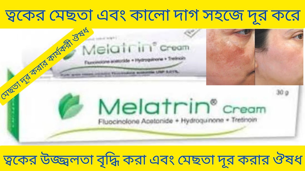 Melatrin cream Bangla/ মুখের মেছতা এবং কালো দাগ দূর করার ক্রিম