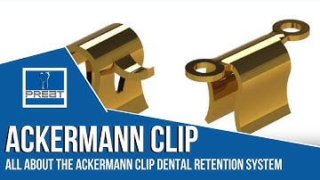 The Ackermann Clip Retention System  By  PREAT Corporation