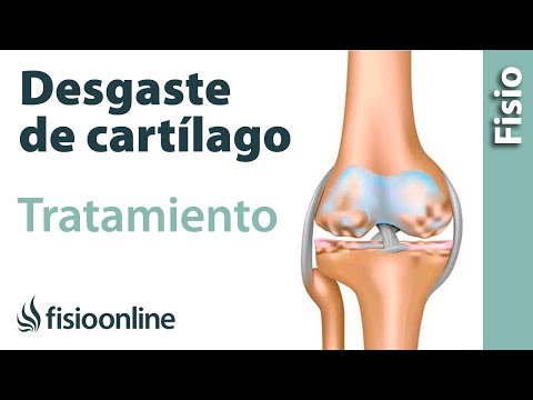 Video: ¿Qué significa reducir el desgaste?