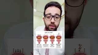 علاج سلس البول | د. محمد حماد