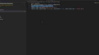 BENR4713 assignment group 7 - image segmentation and enchantment