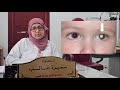 متى يجب فحص عيون الأطفال وماهي مضاعفات عدم الفحص المبكر   د  سميرة غالب نجومي