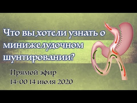 Минижелудочное шунтирование (mini gastric bypass, минишунт, OAGB)