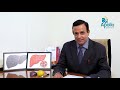 Cirrhosis of Liver-Dr  Shravan Bohra, Liver Specialist at Apollo Hospital Ahmedabad,