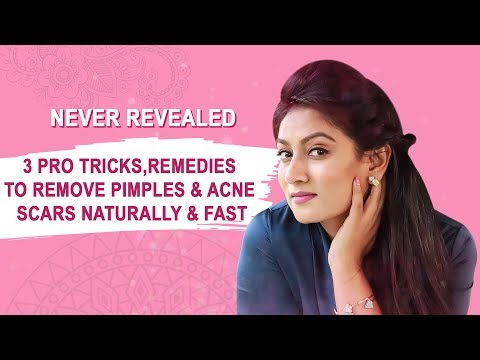  PRO TRICKS, REMEDIES TO REMOVE PIMPLES & ACNE SCARS NATURALLY & FAST  || Ashtrixx