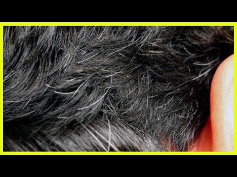 Video: Der Geschwollene Kopf Einer Frau Verdreifachte Sich, Nachdem Sie Sich Die Haare Gefärbt Hatte
