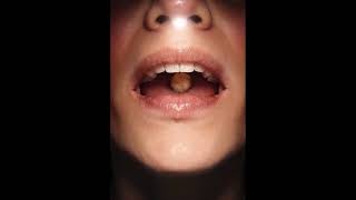 teeth and tongue visualisation function #subscribe 