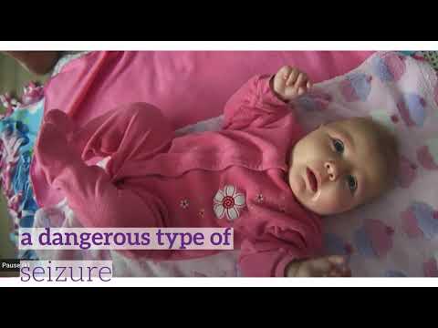 Signs of Infantile Spasms