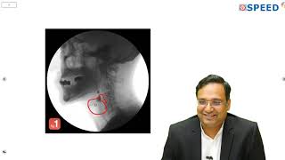 NEET PG 2020 - Surgery Answer Discussion By Dr.K.Vinayak Senthil., M.Ch