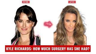 Kyle Richards: Plastic Surgery Analysis! How MUCH Has She Had Done? #rhobh #kylerichards #bravotv