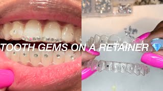 I PUT TOOTH GEMS ON MY RETAINER 💎