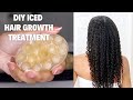 ICING Scalp for hair growth! Only one ingredient and your hair won’t stop growing! | Natural Hair