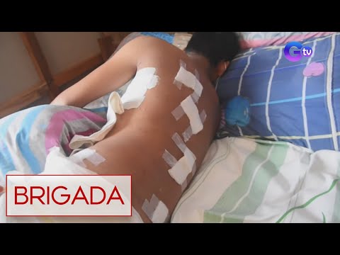 Video: Huwag Kailanman Maliitin Ang Epekto Ng Placebo