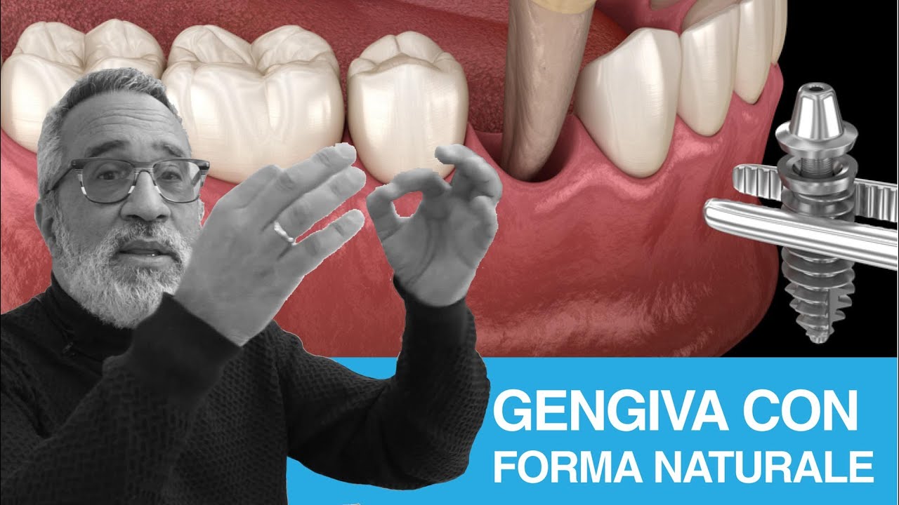 5 Kg. Tirare Il Magnete A Base Rotonda Con Bottone