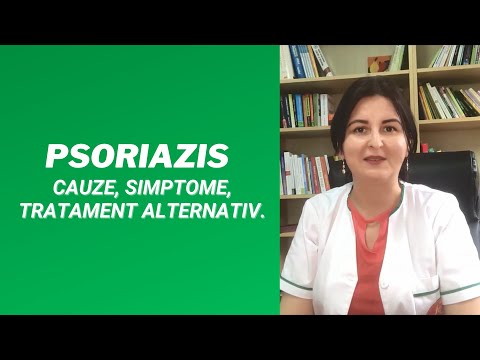 Video: Psoriazis în Jurul Ochilor: Imagini, Simptome, Tratament și Multe Altele