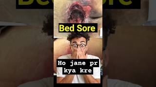 Bed sore😢 l Treatment l #shorts#shortsviral#trending