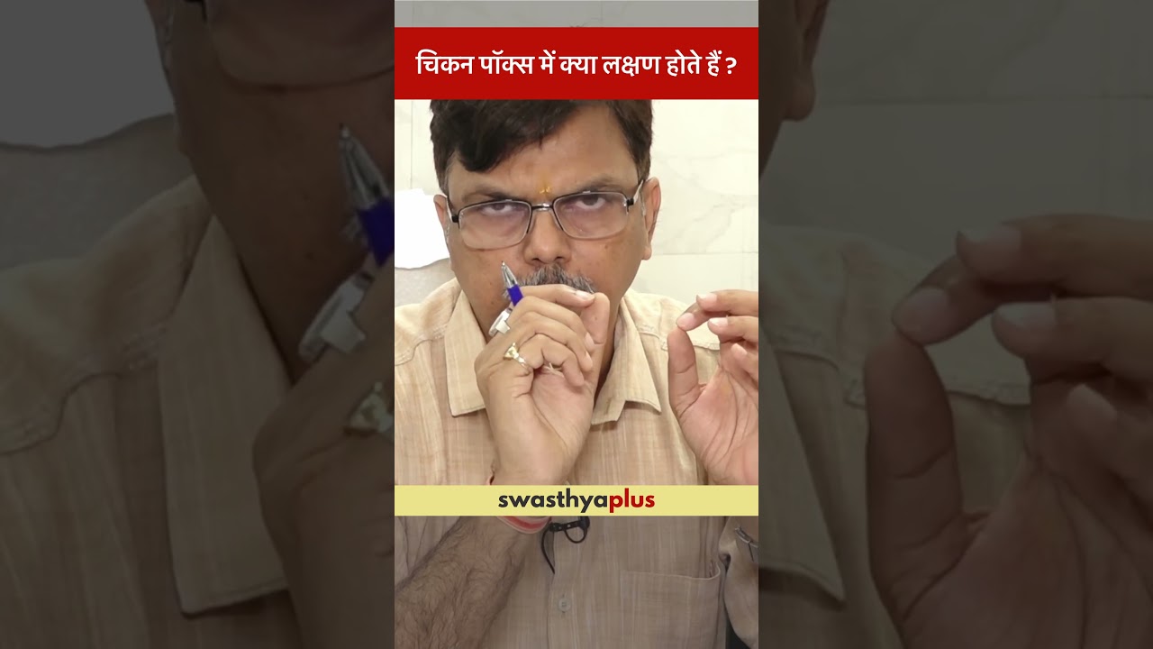 चिकन पॉक्स में क्या लक्षण होते हैं? | Symptoms of Chickenpox | Dr Ajay Shankar Tripathi | #Shorts
