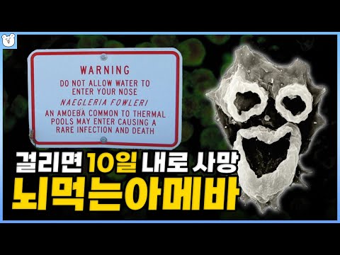 치사율 95%의 뇌 먹는 아메바 ㅇㅇㅇ만 있으면 피할 수 있다고?|파울러 자유 아메바 증상, 감염경로, 예방법