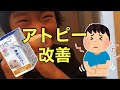 【アトピー 】日本アトピー協会推薦品に認証シャワートレビーノを買ってみた！
