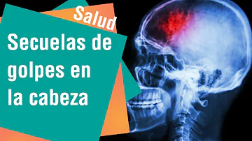 ¿Puede un puñetazo humano romper el cráneo?