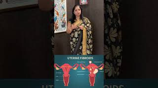 #Hysteroscopy Procedure Explained | Diagnosis & Treatment for #Uterus Problems | Dr.Anusha Reddy B