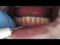 ASMR Dentist 🦷 Teeth Design and Teeth Cleaning l Dentist Cleans Your Teeth!!