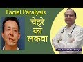 Facial Paralysis (चेहरे का लकवा) | Best Treatment of Paralysis | Top Homeopathic Doctor in Rajasthan