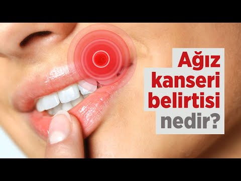 Video: Kotlardaki Lekeleri Çıkarmanın 7 Yolu