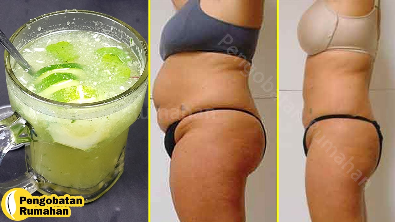 Remedios caseros para perder barriga en una semana