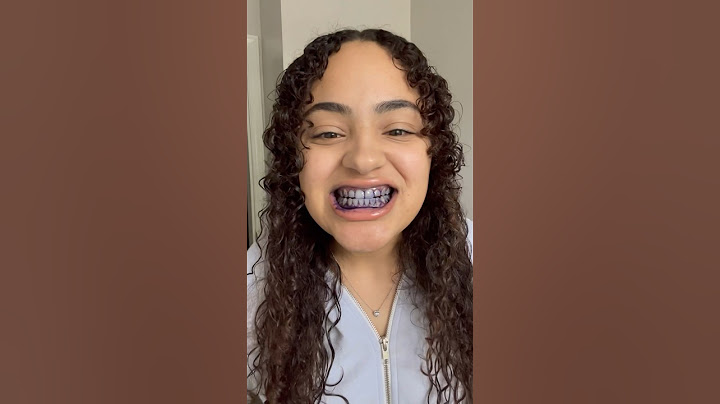 Does The Hismile Teeth Whitening Paste Really Work?