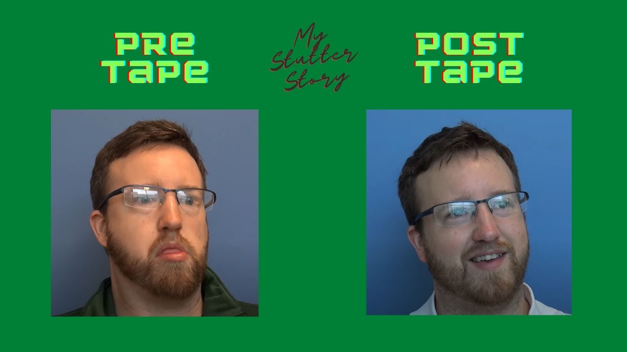 My Stutter Story Breakthrough!