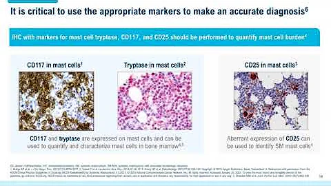 Systemic Mastocytosis: Overview of Disease and Dia...