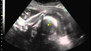 Ultrason Yasmin 19-10-2011