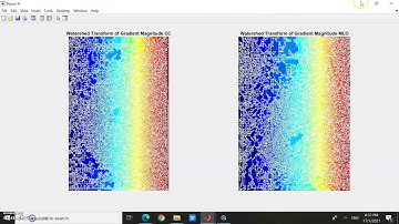 MATLAB & ITS IMAGE PROCESSING TOOLBOX (BREAST MASS DETECTION)-GROUP F