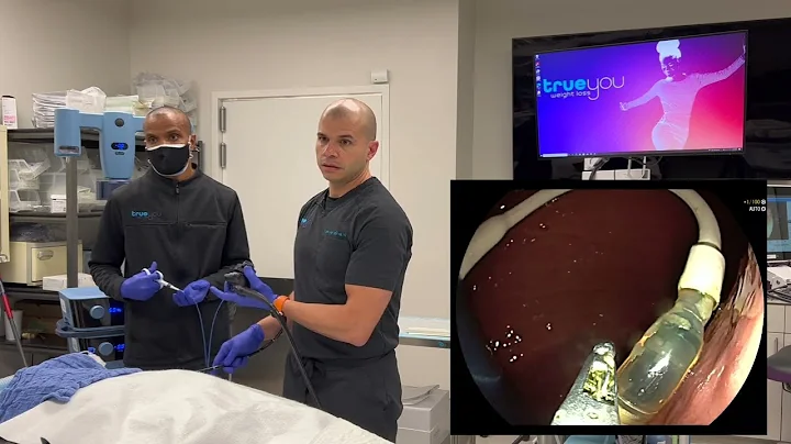 Spatz Gastric Balloon ADJUSTMENT - Full-length pro...