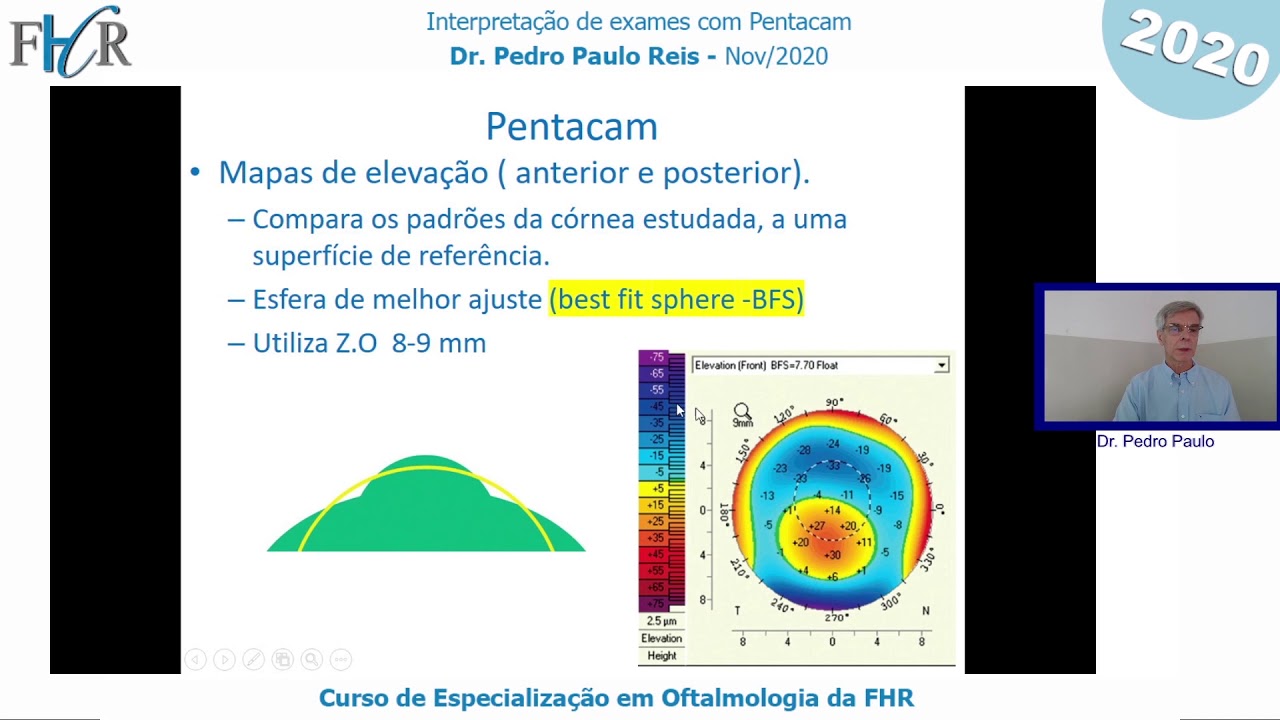Interpretação de Exames com Pentacam_Dr Pedro Paulo Reis_FHR 2020