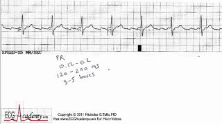 ECG Academy Rhythm ChalkTalk Sample 5