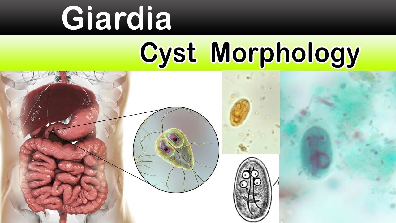 Cât durează giardia în curte, Cât durează giardia în curte