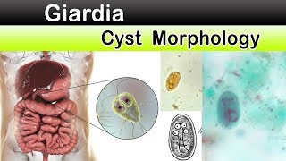 vaccinul giardia vax