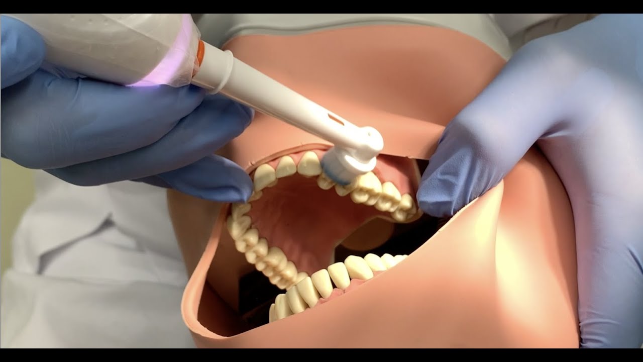 Poetsinstructie elektrische tandenborstel