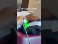 Boost Your Glow: Light Therapy + MDA/Chemical Peel at Chrysalis Pune