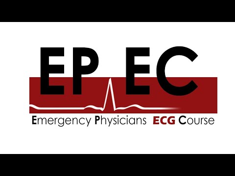 #EPEC ECG Cases (Case 45), Bring your magnifying glass, it is a bit subtle here.