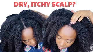 The REAL Reasons Your SCALP is DRY, ITCHY, FLAKY. 7 Tips to MAXIMIZE Healthy Hair Growth: Scalp Care