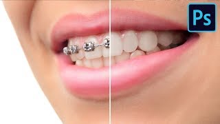 How to Remove Braces in Photoshop screenshot 5